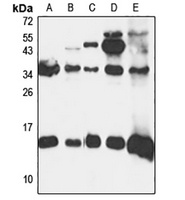 YPEL5 Rabbit Polyclonal Antibody