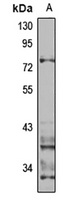 ZBED1 Rabbit Polyclonal Antibody