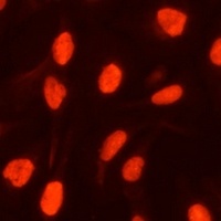 ZBED1 Rabbit Polyclonal Antibody