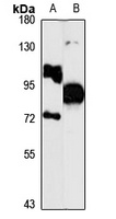 Kaiso Rabbit Polyclonal Antibody