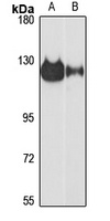ZC3H7A Rabbit Polyclonal Antibody