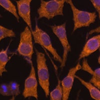 ZC3H7A Rabbit Polyclonal Antibody
