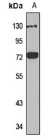 ZDHHC17 Rabbit Polyclonal Antibody