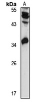 REX-1 Rabbit Polyclonal Antibody
