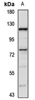 ZNF263 Rabbit Polyclonal Antibody