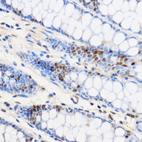 ZNF263 Rabbit Polyclonal Antibody