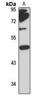 ZP3 Rabbit Polyclonal Antibody