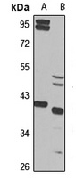 ZWINT Rabbit Polyclonal Antibody