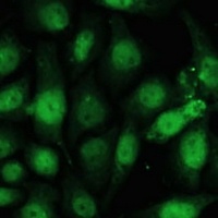 ZWINT Rabbit Polyclonal Antibody