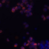 Zyxin Rabbit Polyclonal Antibody