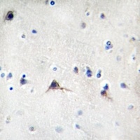 Beta Amyloid Antibody