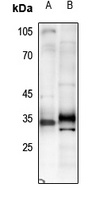 Adiponectin Rabbit Polyclonal Antibody