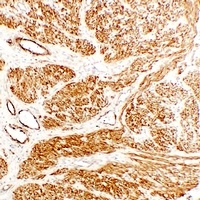 Caldesmon Mouse Monoclonal Antibody