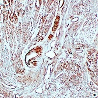Caldesmon Mouse Monoclonal Antibody
