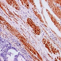 Caldesmon Mouse Monoclonal Antibody