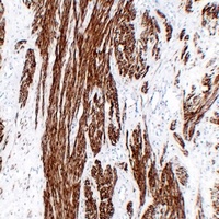 Calponin 1 Antibody
