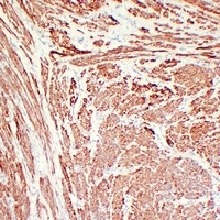 Calponin 1 Antibody