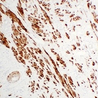 Calponin 1 Antibody