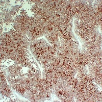 CD99 Mouse Monoclonal Antibody