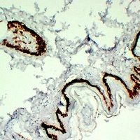 Cytokeratin 15 Antibody