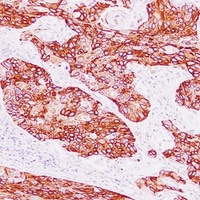 Cytokeratin 15 Antibody