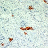 Cytokeratin 16 Mouse Monoclonal Antibody