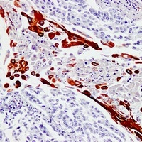 Cytokeratin 16 Mouse Monoclonal Antibody