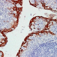 Cytokeratin 16 Mouse Monoclonal Antibody