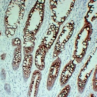 Cytokeratin 20 Mouse Monoclonal Antibody