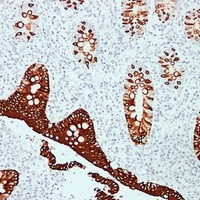 Cytokeratin 20 Mouse Monoclonal Antibody