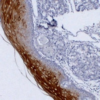 Cytokeratin 4 Mouse Monoclonal Antibody
