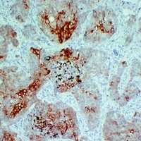 Cytokeratin 5/6 Mouse Monoclonal Antibody