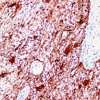 GFAP Antibody