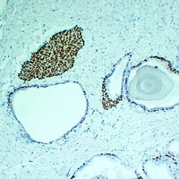 p63 Mouse Monoclonal Antibody