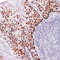 p63 Mouse Monoclonal Antibody