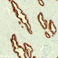 Kallikrein 3 Mouse Monoclonal Antibody