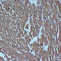 Actin pan Mouse Monoclonal Antibody