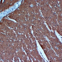 Actin pan Mouse Monoclonal Antibody