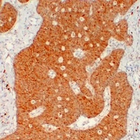 Calretinin Mouse Monoclonal Antibody