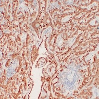 Calretinin Mouse Monoclonal Antibody
