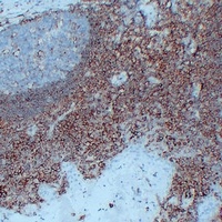 CD44 Mouse Monoclonal Antibody