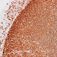 CD45 Mouse Monoclonal Antibody