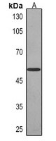 Cytokeratin 14 Mouse Monoclonal Antibody
