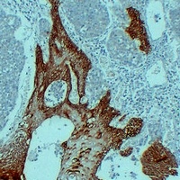 Cytokeratin 14 Mouse Monoclonal Antibody