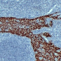 Cytokeratin 14 Mouse Monoclonal Antibody