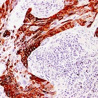 Cytokeratin 14 Mouse Monoclonal Antibody