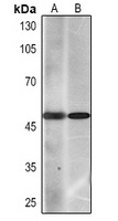 Cytokeratin 7 Mouse Monoclonal Antibody