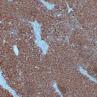 Cytokeratin 7 Mouse Monoclonal Antibody