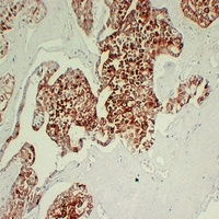 Cytokeratin 7 Mouse Monoclonal Antibody