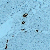Cytokeratin 7 Mouse Monoclonal Antibody